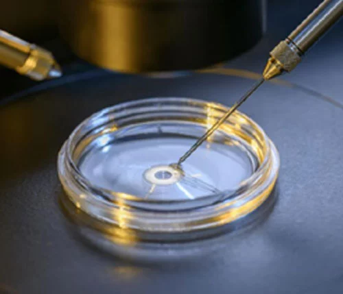IVF — embryo under microscope, in-house embryology at Bliss Fertility Tirur